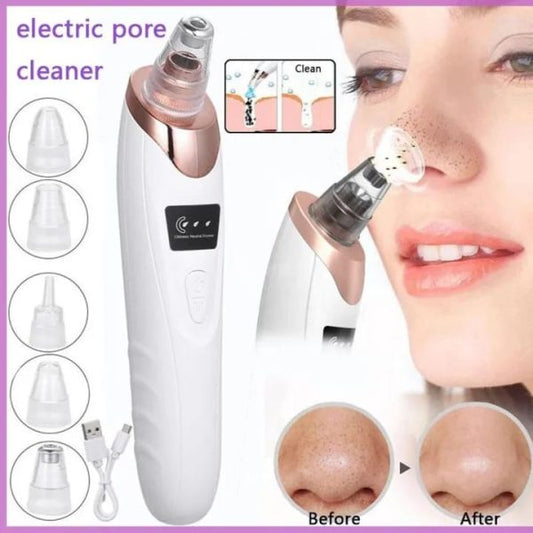 Vaccum Blackhead Remover