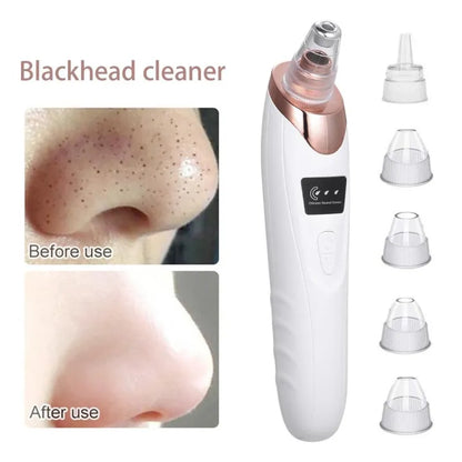 Vaccum Blackhead Remover