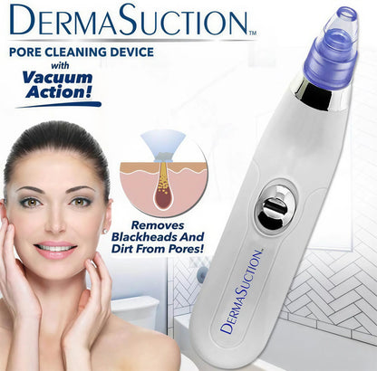 4-in-1 Blackhead & Pore Vacuum